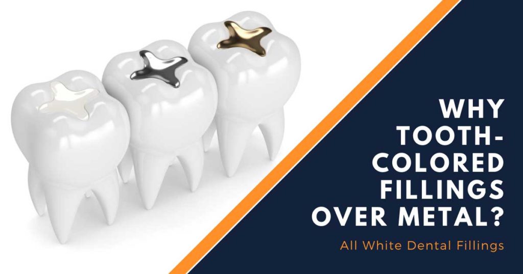 Tooth shop colored fillings
