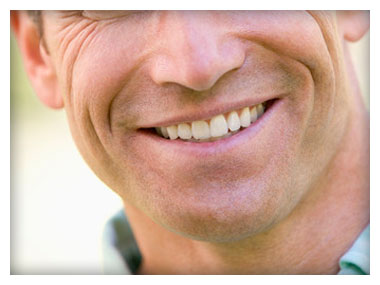 Man With Dental Crowns on Teeth