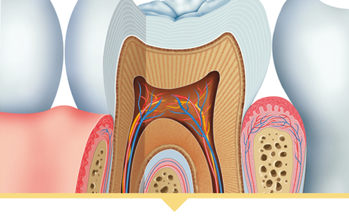 Root Canal Illustration